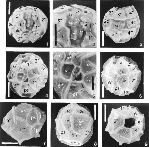 Plate 7. 1–9. Scanning electron photomicrographs of two undescribed species of Histiocysta, from the Maastrichtian Navesink Formation, Atlantic Highlands, New Jersey. Scale bars: figures 1–4, 6–9 = 10 µm; figure 5 = 5 µm. 1–5. Histiocysta sp. B. Figure 1, ventral epicystal tabulation; figure 2, detail of apical region of specimen in figure 1; figure 3, dorsal surface; figure 4, oblique ventral surface of another specimen; figure 5, detail of midventral region of specimen in figure 4. 6–9. Histiocysta sp. C. Figure 6, ventral surface; figure 7, oblique view of ventral hypocyst showing relationships of ps, 1‴, 6‴, 1p, and 1″″; figure 8, left lateral surface; figure 9, apical surface of specimen with operculum missing (note two wall layers, autophragm and ectophragm, and intermediate supporting structures).