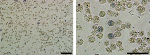 Figure S2 Representative benzidine staining images of K562 cells incubated with 300 mg/L soluplus. Bar represents 100 μm