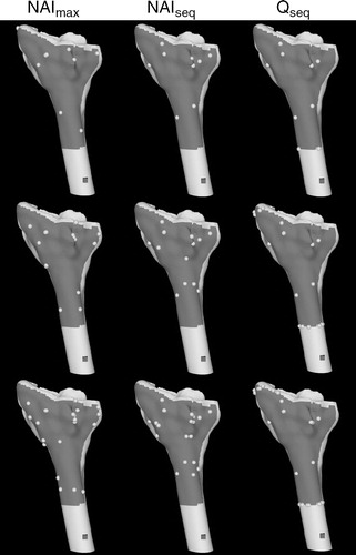 Figure 4. Distal radius surface model and registration points generated using the point-selection algorithms. From top to bottom are point sets of size 9, 18, and 30.