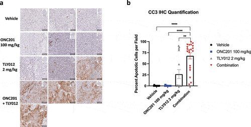 Figure 7. Combination of ONC201 and TLY012 induces potent apoptosis in an HPAFII tumor model in vivo. A) Immunohistochemical analysis of cleaved caspase 3 (CC3) in HPAFII tumor xenograft models treated with three, once weekly doses of ONC201 (100 mg/kg) and TLY012 (2 mg/kg). ONC201 was administered first, and TLY012 was administered 3 days later. Each dose of the combination was administered one week apart. Treatment was initiated once tumors reached between 100–150mm3. Mice were euthanized 1 day after administration of the third dose of TLY012. All scale bars indicate 50 μM. B) Graph showing quantification of 5 20X fields per tumor. * p < .05, ** p < .01, *** p < .001, **** p < . 0001