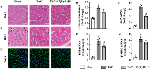 Figure 2 17(R)-Resolvin D1 treatment improves cardiac hypertrophy induced by pressure overload. Histological analyses of the hematoxylin-eosin (HE) staining (A and B), wheat germ agglutinin (WGA) staining (C) and quantification of the average cross-sectional areas (D) in each group (n=3) (Scale Bar, 50μm). Expression of transcripts of hypertrophic biomarkers ANP (E), BNP (F), β-MHC (G) in each group, as determined by RT-PCR analysis (n=4). The data were analyzed using One-way ANOVA followed by Tukey’s post hoc test. Data are presented as the mean ± SEMs. *P < 0.05 compared with the Sham group, #P < 0.05 compared with the TAC group.