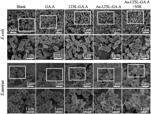 Figure 7. Morphological changes of drug-resistant E. coil (A) and S. aureus (B) through the SEM observed. Cells treated with Au-LTSL-GA.A (50 μg/mL) for 2 h incubation and measured for 5 min upon irradiation (0.25 W/cm2). Cells treated with GA.A (50 μg/mL), LTSL-GA.A (50 μg/mL), Au-LTSL-GA.A (50 μg/mL) were set as control groups. Bacteria without NPs were as blank. The sections in white circles will be enlarged.