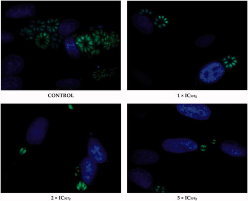 Figure 8. Representative images from Toxoplasma tachyzoites proliferation assay. T. gondii tachyzoites were exposed to the host cells for 3 h. Then, the cell monolayers were rinsed and incubated for a further 24 h in the treatment-20b medium or culture medium alone (control group/untreated group). Untreated parasites (control group) were considered as 100% of invasion. T. gondii – green, cell nuclei – blue.