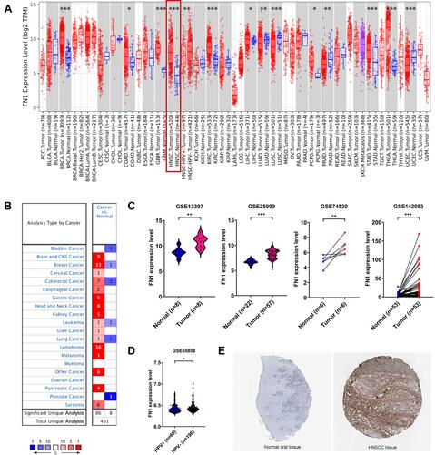 Figure 1 FN1 mRNA and protein levels were elevated in HNSCC. (A) FN1 expression patterns across different tumor types in TIMER. The red box represents HNSCC. (B) FN1 expression patterns across different tumor types in Oncomine. The red box represents HNSCC. The number in each cell present the number of datasets. (C) FN1 expression levels in HNSCC and normal tissues in GSE13397, GSE25099, GSE74530 and GSE142083 dataset. (D) FN1 expression levels in HPV+ and HPV- HNSCC in GSE65858. (E) FN1 protein expression levels in HNSCC and normal tissues, determined by immunohistochemistry staining from HPA website. The results are presented as the mean ± SD, *P < 0.05, **P < 0.01, ***P < 0.001.