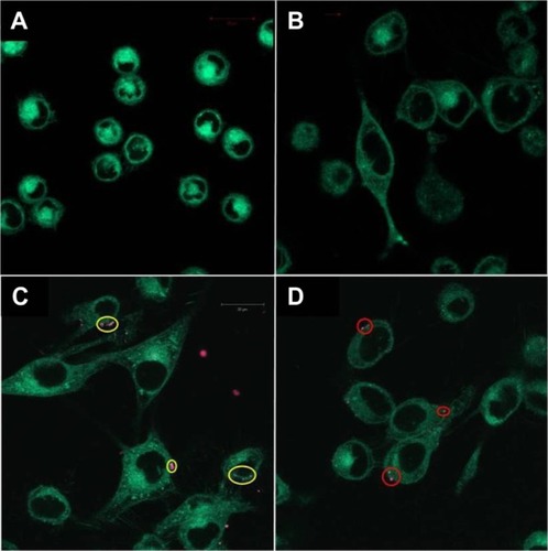 Figure 1 Fluorescence microscopy images of different cell lines incubated with RhB-labeled liposomal nanoparticles. (A) Negative control cell line L-929 showed no binding of RhB-Hybrid-LPs. (B) M21 cells incubated with RhB-NoTarget-LP indicated no cellular interactions. (C) Image of M21 cells showing binding of RhB-RLP (yellow circles). (D) Image of U-87 MG cells showing cellular interactions with RhB-SP-LP (red circles).Abbreviations: Hybrid-LP, liposomal nanoparticle carrying an RGD and SP building block; LP, liposome; NoTarget-LP, liposomal nanoparticle with no targeting sequence; RGD, arginine-glycine-aspartic acid; RhB, Rhodamine-B; RLP, liposomal nanoparticle carrying an RGD building block; SP, substance P.