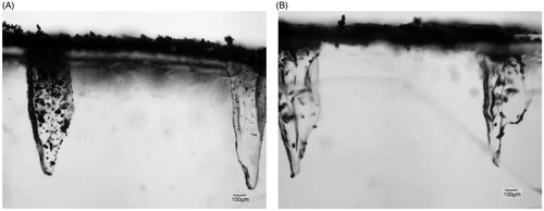 Figure 9. The penetration of stainless steel microparticles in the skin mimicking agarose gel based on the assistance of MNs. (A) Spherical microparticles of 18 μm average diameters, (B) irregular microparticles of 30 μm average diameters.