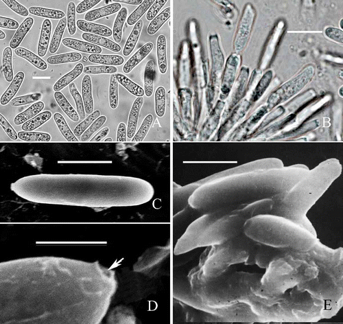 Figure 2. Morphological characteristics of C. horii from Diospyros kaki cv. Wuhesh. A-B, conidia on natural host. A, conidia. B, conidiophores and conidia. C-E, transmission electron micrographs showing conidia. C, straight conidium with obtuse apex and truncate end. Bar = 10 mm. D, a conidium with broken hilum at its base (arrow). E, conidia embedded within and surrounded by the mucilage in acervulus. Bar = 10 μm.