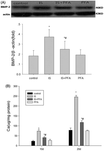 Figure 3. The role of Pit-1 in IS-induced osteoblast differentiation of VSMCs. (A) Top panels: representative western blots of BMP-2 when incubated VSMCs with 500 μM IS and 0.5 mM PFA. Graphs: quantification of the expression. (B) Calcium content of VSMCs cocultured with PFA, for 10 or 20 days with the indicated treatment. Results are presented as percentage of control values and are mean ± SD of three independent experiments. *p < 0.05, compared with the control group. #p < 0.05, compared with the IS-stimulated group.