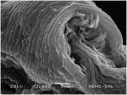 Figure 5. Magnification of the scolex of T. tetragona treated with A. oleracea extract. A single sucker indicates removal and detachment of spines.