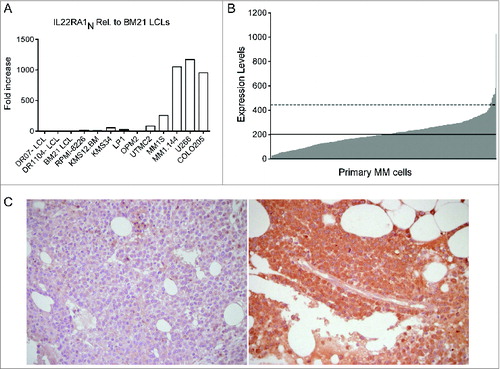 Figure 4. IL-22RA1 is expressed in a fraction of MM cell lines and primary tumors. (A) mRNA expression of IL-22RA1 in MM cell lines. COLO205 cells were positive controls. Epstein–Barr virus-transformed B lymphoblastoid cell lines (LCLs) were negative controls. (B) mRNA expression of IL-22RA1 in primary MM cells of a cohort of 414 newly diagnosed patients described in ref. 34. The expression pattern for the probe set 220056_at is shown. Continued line: median. Dotted line: 2× standard deviation. (C) IL-22RA1 protein expression in BM biopsies from MM patients #121 (negative) (left) and #177 (positive) (right). Images were acquired at a ×40 magnification.