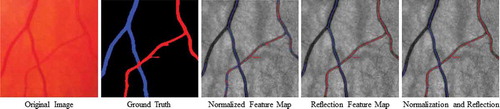 Figure 4. Examples of A/V pixel-wise classifications by using different feature subsets. The last column shows the classifications using total 45 features including all the normalised intensities and the reflection features (Huang et al. (Citation2017a)). Blue indicates veins and red indicates arteries.