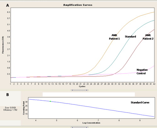 Figure 1. RQ PCR for assessment of the BAX transcripts in AML patients. (A) Amplification curves for 2 AML patients with the standard of known concentration and negative control. (B) Standard curve for the quantification of the BAX transcript.