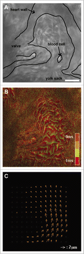 Figure 4 Brightfield high-speed imaging and flow analysis allow imaging at high framerates, and resolve motion of individual blood cells in the cardiac tract for subsequent flow velocity estimation. (A) Brightfield image of the beating embryonic heart of a wild type 83 hpf zebrafish at 3,000 frames per second. (B) Qualitative motion representation by superposition of 5 successive frames, each with a hue corresponding to its relative time stamp. (C) Local motion estimation of red blood cells and heart wall motion reveals velocities as high as 17 mm/s. The corresponding high temporal-resolution data are provided in Movie 2. scale bar is 20 µm.