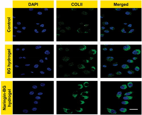 Figure 4. Collagen II of chondrocytes observation by immunofluorescence staining with control, BG hydrogels and Naringin–BG hydrogels groups. Scale bar 10 µm.