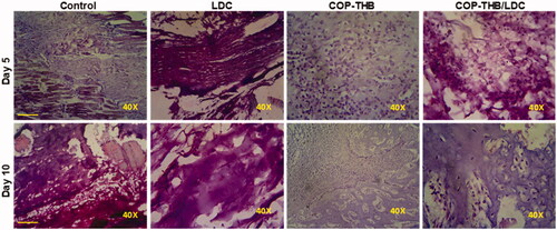 Figure 10. Histopathological evaluation of the anti-inflammatory effects of COP–THB/LDC against CGN-induced inflammation on days 5 and 10. Paraffin sections of rats hind paw were stained with hematoxylin and eosin (H&E) (scale bar = 100 μm).