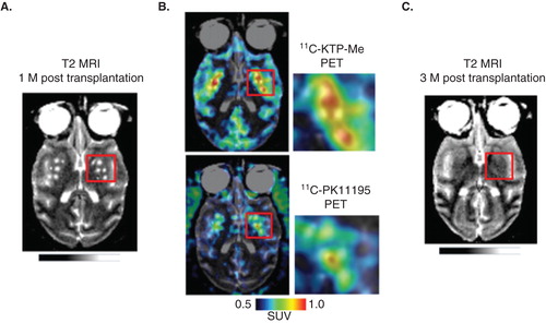 Figure 2. Potential predictability of the post-graft inflammatory response for delayed graft cell death. A. T2-weighted MRI brain image of a PD model animal, in which human embryonic stem cells were transplanted bilaterally in the striatum 1 month before MRI scan. B. At the same time point, PET ligands for activated glia, 11C-ketoprofen methyl ester (upper) and 11C-PK11195 (lower) were accumulated in the grafted areas of striatum, suggesting that host tissues have significant immune reactions to the grafted cells. C. Follow-up T2-weighted MRI scan in the same animal (3-month post-transplantation), which showed disappearance of grafts at this later stage. These findings suggest potential usefulness of multi-modal neuroimaging in predicting the long-term graft survival from early stage information of graft–host immune interaction. Unpublished data, courtesy of Prof. Jun Takahashi at Kyoto University.