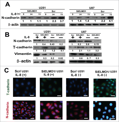 Figure 4. IL-8 enhanced cell mesenchymal properties and induced MT via ELMO1. (A) The expression of N-cadherin in Scr/U251, SiELMO1/U251, Scr/U87 and SiELMO1/U87 cells with 10 ng/mL IL-8 at different time points. β-actin was used as a loading control. Each result is representative from at least 3 independent experiments. Quantification of relative protein levels is shown below the blots. (B) Expression of glial markers, T-cadherin, as well as mesenchymal markers, N-cadherin and vimentin, were examined by Western blot in Scr/U251, SiELMO1/U251, Scr/U87 and SiELMO1/U87 cells with or without 10 ng/mL IL-8 for 24 h. β-actin was used as a loading control. Each result is representative from at least 3 independent experiments. Quantification of relative protein levels is shown below the blots. (C) Fluorescence microscopic staining of T-cadherin (green) and N-cadherin (red) is indicated in Scr/U251 and SiELMO1/U251 cells with or without IL-8 for 24 h. Nuclear DNA was stained with DAPI (blue). Scale bar: 10 um. Data were collected in this set of figures from a representative of at least 3 independent experiments.