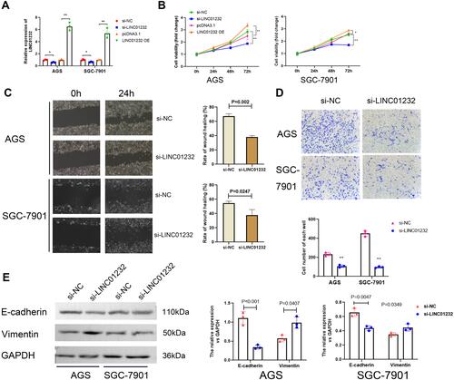 Figure 2 The effects of LINC01232 on gastric cancer cells. (A) The expression of LINC01232 was detected by qRT-PCR after gastric cells transfected with LINC01232 siRNA and overexpressing vector plasmids, si-NC and pcDNA3.1 plasmids were used as the control, *P<0.05, **P<0.01. (B) The cell proliferation of AGS and SGC-7901 was analyzed using CCK8 assays, *P<0.05, **P<0.01. (C) The invasion ability of AGS and SGC-7901 cells after treated with LINC01232 siRNA or overexpressing vector plasmids for 24h and 48h was tested by wound healing assays. (D) The migration ability of AGS and SGC-7901 cells after treated with LINC01232 siRNA or overexpressing vector plasmids for 24h and 48h was tested by transwell assays, **P<0.01. (E) The protein levels of E-cadherin and vimentin in AGS and SGC-7901 cells transfected with LINC01232 siRNA or overexpressing vector plasmids was analyzed using Western blotting, GAPDH used as the internal control.