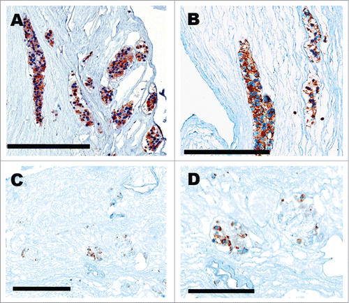 Figure 4. 3-day incubation of scaffold after retrograde seeding of pancreatic β cells. Cells showing positive insulin immunoreactivity localized to the collecting tubules (A, B) and glomeruli (C, D). Scale bar 200 μm (A–C) 100 μm (D).