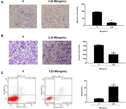 Figure 3 MI inhibits laryngeal cancer cell migration and invasion and enhances cell apoptosis in vitro. (A) The cell migration was examined by transwell assays in the HEP-2 cells treated with MI at indicated dosage. (B) The cell invasion was examined by transwell assays in the HEP-2 cells treated with MI at indicated dosage. (C) The cell apoptosis was measure by flow cytometry analysis in the HEP-2 cells treated with MI at indicated dosage. Data are presented as mean ± SD. Statistic significant differences were indicated: ** P < 0.01.