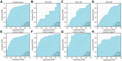 Figure 4 ROC curve of SNTG2 mRNA expression in LUAD cohort. (A) ROC curve of SNTG2 mRNA expression in normal and tumor patients, (B–D) subgroup analysis for patients’ response of PR, SD, PD after primary therapy compared with CR, (E–H) subgroup analysis for stage I, II, III and IV, respectively.