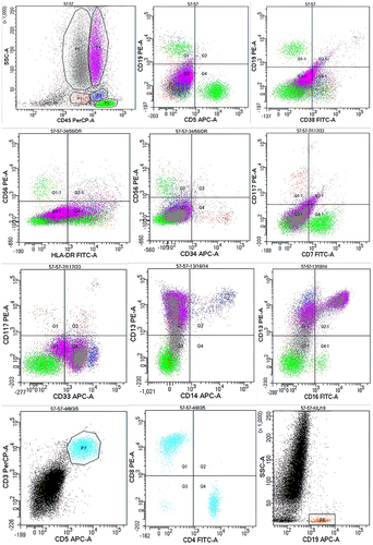 Figure 3 Flow cytometry (FCM) of Loeffler endocarditis with significant myeloid hypereosinophilia.