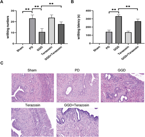 Figure 4 Inhibitory effects of Terazosin on the anti-PD effect of GGD. (A) The writhing numbers of rats in each group. (B) The writhing latency of rats in each group. (C) Pathological changes in the uterine tissue of rats in each group by H&E staining (Magnification × 200). Data are presented as the means ± SD. **P<0.01, n=6.