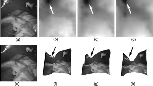 Figure 9. A pair of stereo-images (a and e) from an in vivo stereoscopic laparoscope sequence and three temporal frames of the reconstructed depth map (b–d) and their corresponding 3D rendering results (f–h). Arrows indicate visible errors in the recovered depth due to specular highlights. [Color version available online]