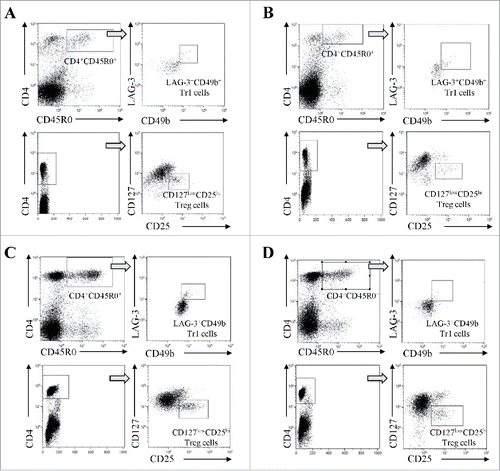 Figure 1. Representative dot plots and gating strategies for the characterization of CD4+CD127lowCD25hi Treg cells (upper panels) and CD4+CD45R0+LAG-3+CD49b+ Tr1 cells (lower panels) in BM samples from healthy donors (panel A) and NB patients (panel B) and in PB samples from healthy children (panel C) and NB patients (panel D).