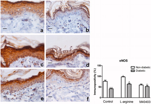 Figure 2. Immunohistochemical staining for eNOS in the skin of non-diabetic control (a), diabetic untreated (b), non-diabetic L-arginine-treated (c), diabetic L-arginine-treated (d) non-diabetic M40403-treated (e) and diabetic M40403-treated (f) rats. Visualization of the antibody-antigen reaction is accomplished by the use of a secondary antibody conjugated to peroxidase, which catalyses a brown color-producing reaction. Data obtained after quantitative evaluation of immunohistochemistry images represent the mean ± SEM. *Comparison with non-diabetic untreated control, *p < .05; ***p < .001. #Comparison with diabetic untreated control, #p < .05. Magnification: 40× orig.; insets 63×. eNOS, endothelial NOS.