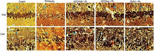 Figure 3. Composite photomicrograph of CA1 and CA3 hippocampal subfields of the brain of rats treated with Pb, AD + Pb and DSMA + Pb showing normal pyramidal cells in A and F, mild distortion in C, D and E and degeneration and neuronal loss in B, G, H, I and J. Bielschowsky x 400