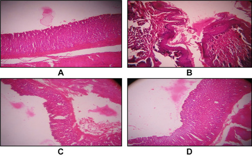 Figure 2 Light of microphotographs of crossed sections of animals skin (A) Group 1: animals received a normal diet, (B) Group 2: animals with topical exposure of DMBA and croton oil, (C) Group 3: animals with topical exposure of DMBA+ croton oil and an oral dose of 100 mg/kg combine drug sample and (D) Group 4: animals with topical exposure of DMBA+ croton oil and an oral dose of 200 mg/kg combine drug sample.