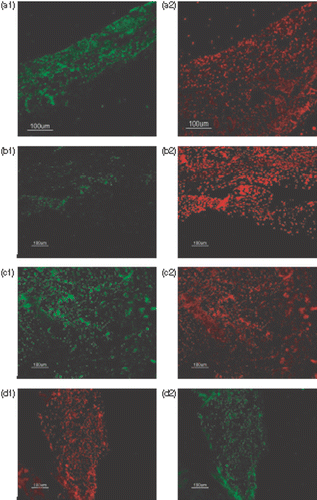 Figure 4. Inducible NOS immunohistochemistry 24 h after the skin burn injury. The sections were nuclear counterstained with propidium iodide. (a1) A burned skin section of left flank of one mouse (group 1: burn without any treatment). (a2) Nuclear counterstaining of the same section. (b1) A burned skin section of right flank of the same mouse. Hyperthermia was done for the burned skin. (group 2). (b2) Nuclear counterstaining of the same section. (c1) A burned skin section of the right flank of a mouse. NLX has been administered for the mouse 30 min before burn injury (group 3). (c2) Nuclear counterstaining of the same section. (d1) A burned skin section of right flank of a mouse. NLX has been administered for the mouse 30 min before the burn injury and hyperthermia has been done for the burned skin. (group 4). (d2) Nuclear counterstaining of the same section. NLX: Naloxone.