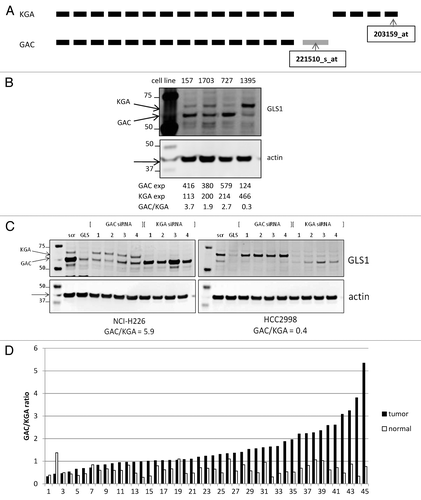 Figure 5. Analysis of GLS1 splice variant expression/ratio. (A) Schematic representation of GLS1 splice variant transcripts, and the location of the variant specific probes. (B) NSCLC cell lysates were analyzed for GLS1 expression. Transcript expression levels are depicted as Affymetrics MAS5 values. (C) Cell lines with varying GAC:KGA ratios were transiently transfected with siRNA oligos for either GAC or KGA after which GLS1 splice variant expression was analyzed by western blot analysis. (D) NSCLC tumors and matched normal lung tissues were analyzed for GAC:KGA ratio.