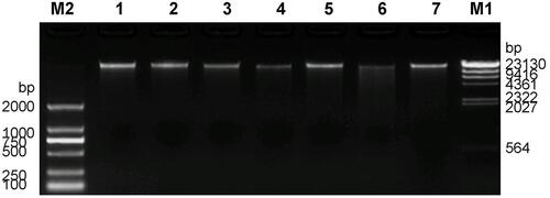 Figure 2 Agarose gel electrophoresis of 7 DNA samples from family members. M1 is λ-Hind III digest DNA Ladder. M2 is D2000 DNA Marker, and 1–7 are DNA samples.
