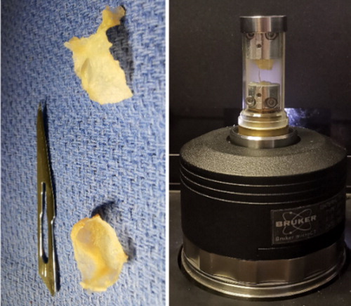 Figure 1. Bone samples and micro-CT loading cell.