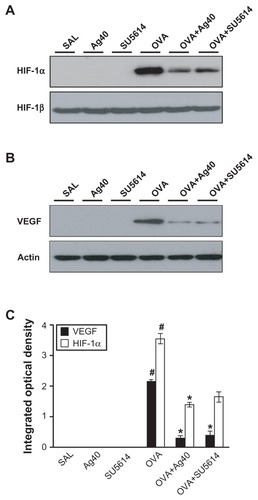 Figure 3 Effect of silver NPs on the protein expression of HIF-1α and VEGF in lung tissues collected from ovalbumin-sensitized and ovalbumin-challenged mice. HIF-1α or VEGF was measured 48 hours after the final challenge in saline-inhaled mice administered saline (SAL), saline-inhaled mice administered 40 mg/kg of silver NPs (Ag40) or SU5614 (SU5614), ovalbumin-inhaled mice administered saline (OVA), and ovalbumin-inhaled mice administered 40 mg/kg of silver NPs (OVA+Ag40) or SU5614 (OVA+SU5614). (A) Western blot analyses of HIF-1α and HIF-1β from lung tissues. (B) Western blot analyses of VEGF from lung tissues. (C) HIF-1α and VEGF protein levels in A and B, respectively, were quantified using a Gel-Pro Analyzer and plotted as the integrated optical density, using Microsoft Excel. Densitometric analyses are presented as the relative ratio of each molecule to HIF-1β or actin.Notes: Bars indicate the mean ± standard error of the mean and are representative of eight independent experiments using different preparations of total lung extracts.*P < 0.05 versus OVA; #P < 0.05 versus SAL.Abbreviations: HIF, hypoxia-inducible factor; NP, nanoparticle; VEGF, vascular endothelial growth factor.