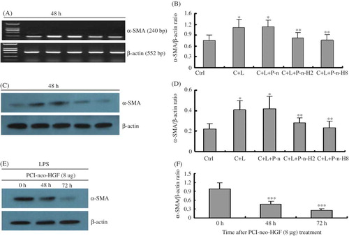 Figure 2.  PCI-neo-HGF transfection inhibits α-SMA expression in glomerulus mesangial cells stimulated by LPS. (A) RT-PCR analysis of α-SMA mRNA level 48 h after transfection. (B) Densitometric analysis of α-SMA mRNA normalized to β-actin. (C) A representative Western blot analysis of α-SMA protein level 48 h after transfection. (D) Densitometric analysis of α-SMA protein normalized to β-actin. (E) Western blot analysis of α-SMA protein level after transfection with PCI-neo-HGF (8 μg) at different time points. (F) Densitometric analysis of α-SMA protein normalized to β-actin. α-SMA protein expression decreased gradually with time. Ctrl, contral; C + L, cells + LPS; PCI-n, cells + LPS + PCI-neo (2 μg); P-n-H2, cells + LPS + PCI-neo-HGF (2 μg); P-n-H8, cells + LPS + PCI-neo-HGF (8 μg). *p < 0.05 versus Ctrl group; **p < 0.05 versus C + L group, ***p < 0.05 versus 0 h.