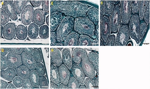 Figure 4. Photomicrographs of testicular sections stained with PAS. Note the intense pink colour and PAS-intensity of tubular cells in groups E, F and G. Control sections showed well stained and preserved architectural layout with preserved seminiferous tubular integrity. Evidence of hypoplasia with poor PAS staining in some tubules (G & H).
