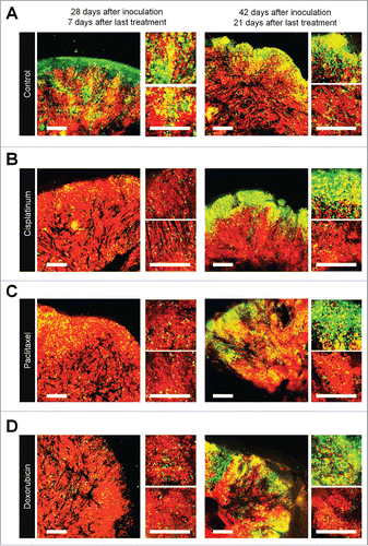 Figure 1. Quiescent cancer cells are resistant to chemotherapy. Experimental setup: FUCCI-expressing MKN45 cells (5×106 cells/mouse) were injected subcutaneously into the left flanks of nude mice. When the tumors reached approximately 6 mm in diameter (tumor volume, 80–100 mm3), mice were intraperitoneally injected with cisplatinum (CDDP) (4 mg/kg), paclitaxel (PTX) (5 mg/kg) or doxorubicin (DOX) (6 mg/kg) for 3 cycles every 3 d. Representative images of cross-sections of FUCCI-expressing MKN45 subcutaneous tumor of control (A), treated with CDDP (B), PTX (C), or DOX (D) 7 d and 21 d after last treatments. Low-magnification image (left). High-magnification image (right). Superficial area image (upper right), deep area image (lower right of the upper and lower subpanels, respectively, in each panel). The cells in G0/G1, S, or G2/M phases appear red, yellow, or green, respectively. (E, F) Histograms show cell-cycle phase of FUCCI-expressing MKN45 subcutaneous tumors of control (A); treated with CDDP (B); PTX (C); or DOX (D). Data are shown as means ± SD (n = 5). Scale bars, 500 μm.