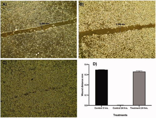 Figure 3. Effect of compound 12a on cells migration and healingefficacy of Caco-2 cells.