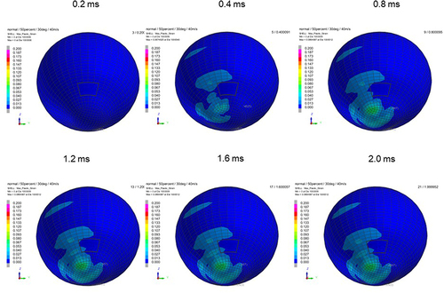 Figure 6 Sequential strain strength response of ocular surface of model eye upon airbag impact in 30°-gaze down position at 40 m/s with adhesion strength of scleral flap of 50%, shown at 0.4-ms intervals after 0.2 ms. Strain strength change is displayed in color as presented in the color bar scale (Figure 2).