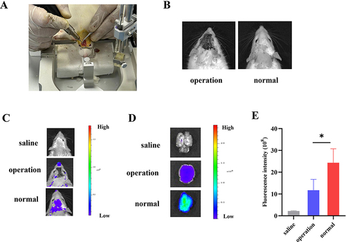 Figure 5 Observation of brain fluorescence after intranasal administration of MM-Lip-DiD formulations to olfactory nerve blockade model rats and normal rats. (A) Establishment of an olfactory nerve blockade model in rats. (B) Successfully modeled rats and normal rats. (C) Live imaging of MM-Lip-DiD distribution in the rat brain. (D) Ex vivo images of MM-Lip-DiD distribution in the rat brain. (E) Quantitative analysis of DiD fluorescence intensity in brain tissue. The data were presented as the mean ± SD (n =3). *p < 0.05.