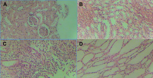Figure 5 The histopathological evaluation of renal tissue before and after irradiations. (A) is normal tissue, (B) shows hemorrhage in the kidney, (C) shows edema and inflammation, and (D) shows tubular dilatation after irradiations.