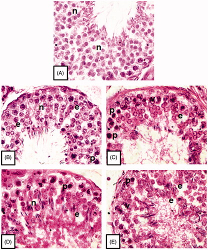 Figure 3. Microphotographs of testicular tissue showing histopathological alterations in testicular cells post treatment with different compounds (B–E) at 10 μM concentration for 6 h duration in comparison to the control (A). n: normal healthy cells; p: pyknotic nuclei; e: empty spaces, v: cytoplasmic vacuolisation (H & E stain, 1000×).