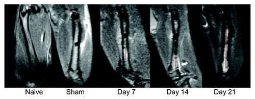 Figure 2. MRI images of bone cancer-bearing rat femurs. Sagittal planes of the femur at different stages of tumor progression. T2 magnetic resonance images (MRI) of a rat coping with femoral bone show tumor-affected part of the femur (red line). Tumor proliferation affects the regular cortical line at day 14 (white arrowhead).