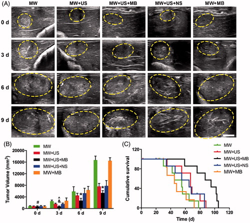 Figure 6. Growth inhibition of residual tumours and survival analysis in VX2 rabbits. (A) Ultrasonography of liver tumours in different T-Groups before and after ablation 3 d, 6 d and 9 d. Scale bar: 10 mm. (B) Tumour volume in each T-Group after ablation 3 d, 6 d and 9 d (#p > .05 vs. other T-Groups at day 0; &p > .05 vs. MW + US and MW + US + NS T-Groups at day 3; ^p < .01 vs. MW and MW + MB T-Groups at day 3; *p < .001 vs. other T-Groups at days 6 and 9, respectively; n = 8). (E) Cumulative survival of VX2 rabbits in different T-Groups after ablation (n = 8).