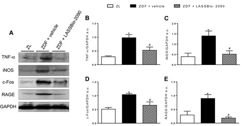 Figure 5 Effects of T2DM model on LV protein expression and treatment with vehicle or LASSBio-2090. Figure (A), representative Western blot images of TNF-α, iNOS, c-fos, RAGE and GAPDH (loading control). Figure (B–E), densitometric ratio of TNF-α (B), iNOS (C), c-fos (D) and RAGE (E). Data represent the mean ± SEM (n = 6 rats per group). *p < 0.05 compared with ZL group; #p < 0.05 compared with ZDF group treated with vehicle. Ordinary one-way ANOVA with Dunnett’s multiple comparisons test.