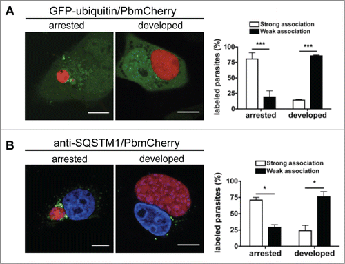 Figure 8. Persistence of ubiquitination and SQSTM1 in arrested parasites. (A) GFP-ubiquitin-transfected HepG2 cells infected with mCherry-expressing P. berghei sporozoites were monitored by live microscopy 48 hpi. Scale bars: 10 µm. The strength of ubiquitin-positive staining around the parasite was scored as described for ubiquitin in the legend to Figure 7A. Each bar indicates the average of 2 independent experiments. Standard deviations are depicted. P < 0.0001. (B) HepG2 cells were infected with mCherry-expressing P. berghei sporozoites, fixed 48 hpi, and stained with antibodies specific for SQSTM1 (green). DNA was stained with DAPI. Scale bars: 10 µm. The strength of SQSTM1-positive staining around the parasite was scored as strong or weak as described for ubiquitin in the legend of Figure 7A. Each bar indicates the average of 2 independent experiments. Standard deviations are depicted. Arrested P = 0.0177. Developed P = 0.042.