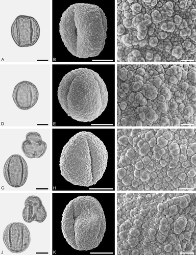 Figure 9. LM (A, D, G, J) and SEM (B, C, E, F, H, I, K, L) micrographs of dispersed fossil Fagaceae pollen. A–L. Quercus sp. 6 (Quercus Group Quercus/Lobatae), close-ups of central mesocolpium. Scale bars – 10 µm (A, B, D, E, G, H, J, K), 1 µm (C, F, I, L).